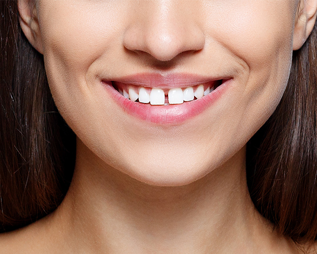 Cosmetic Restoration